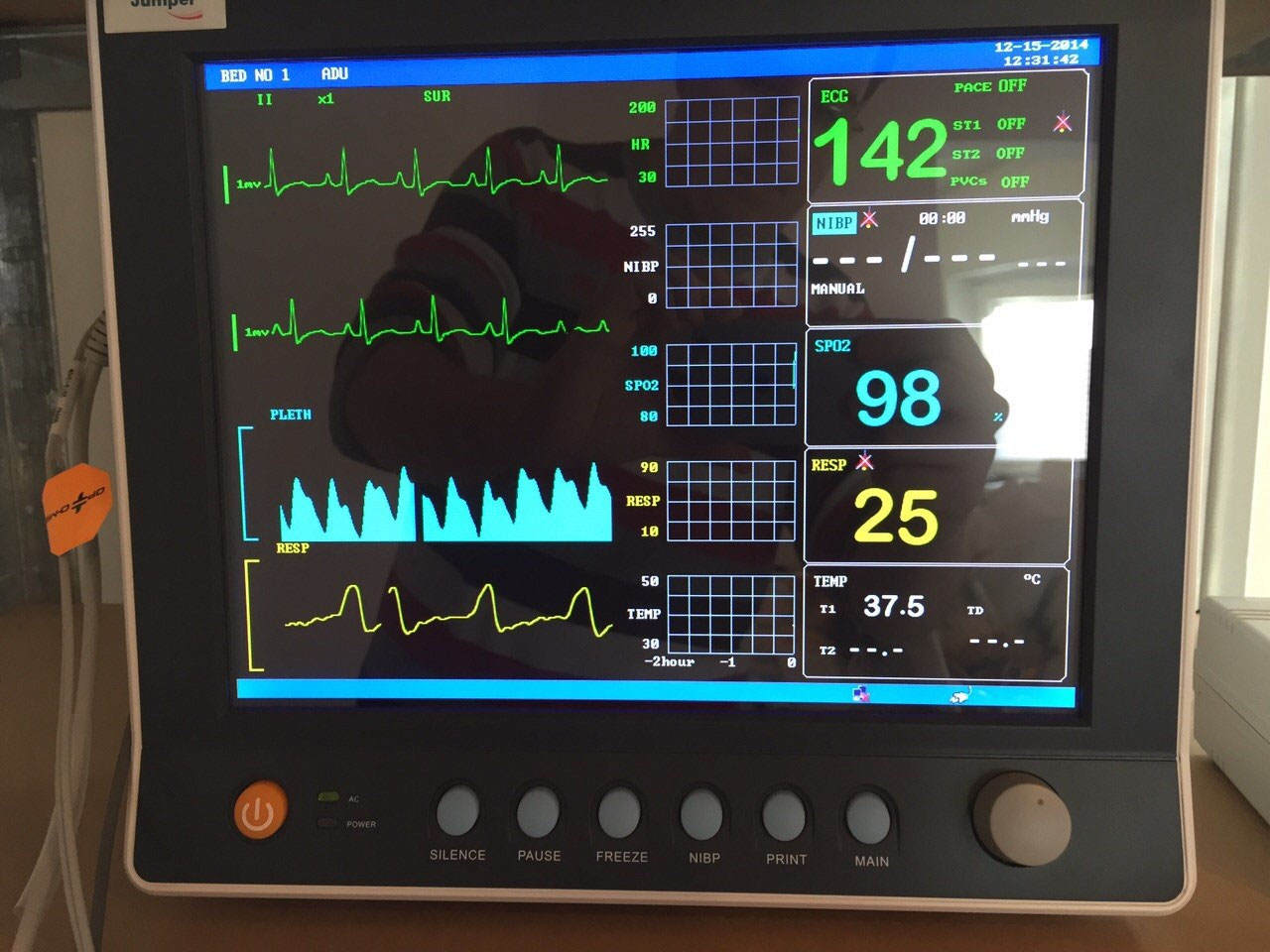 Patientenmonitor zur Narkoseüberwachung
